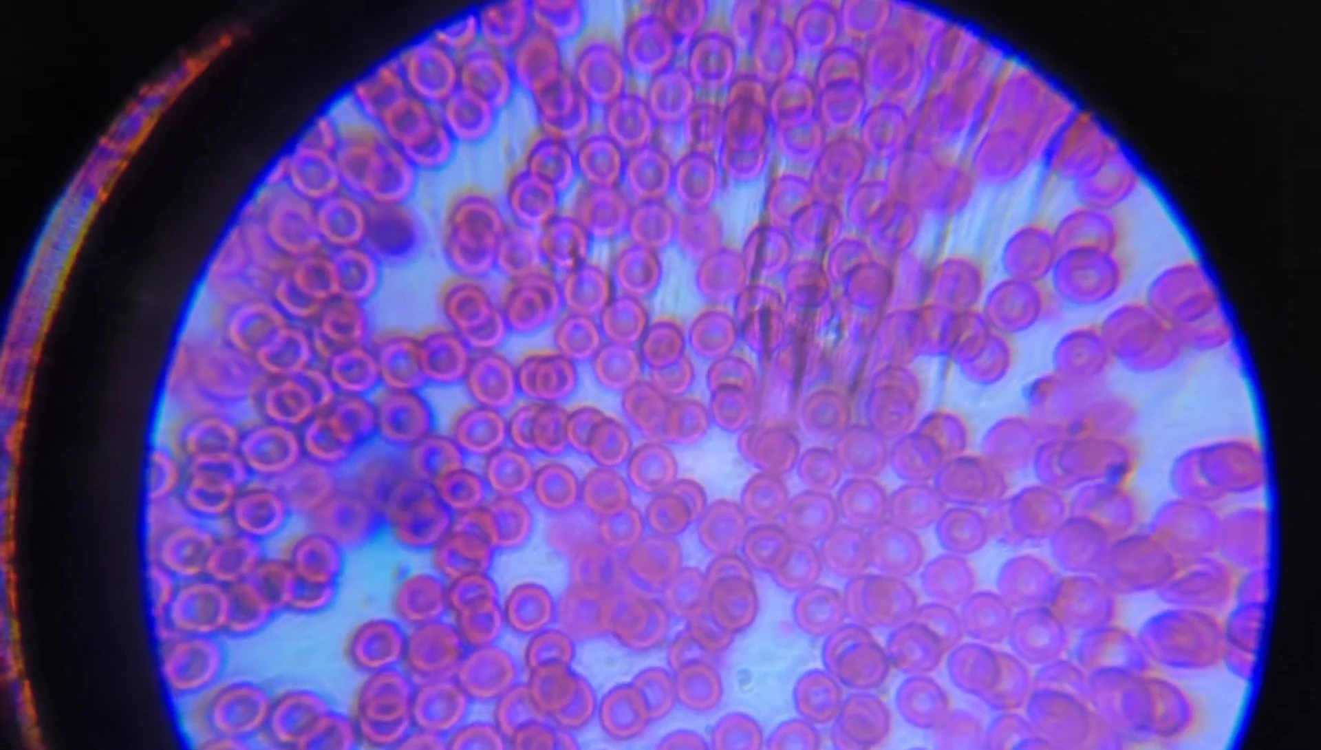 Image of red blood cells under the microscope